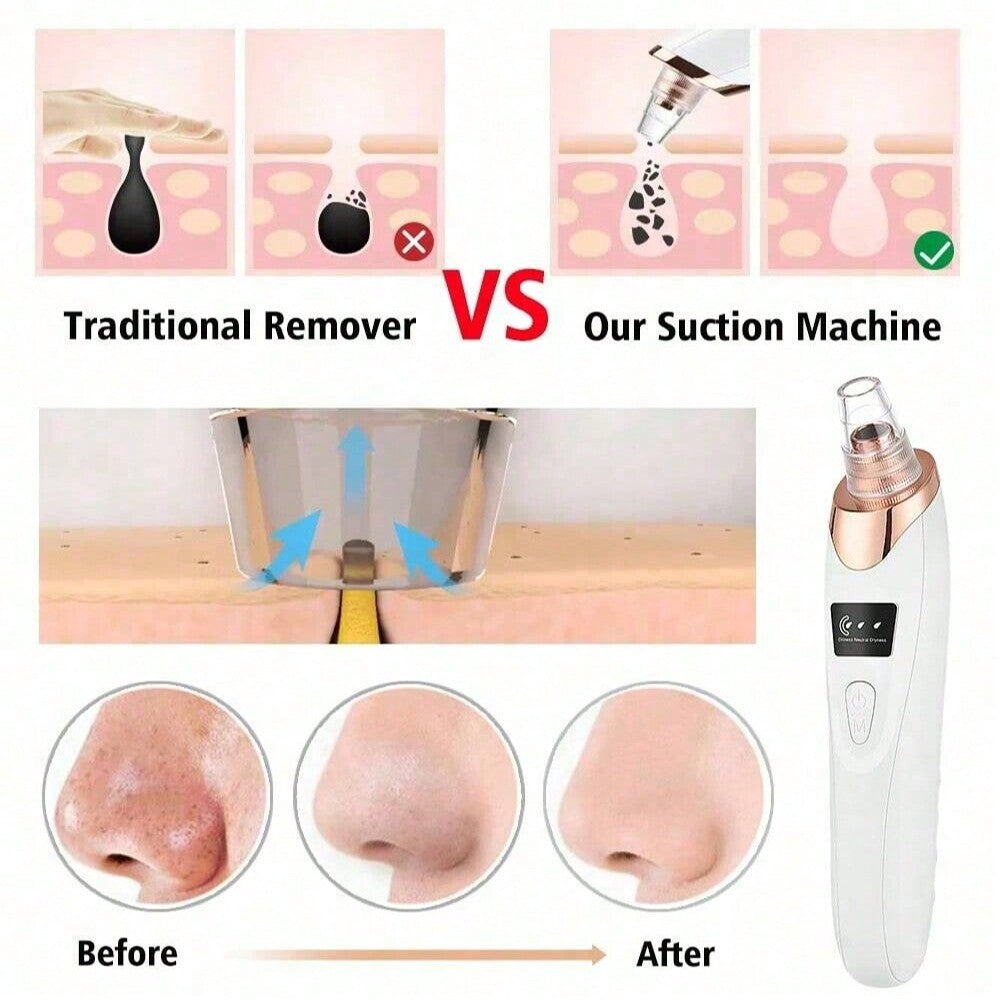 Electric Acne Pore Cleaner & Blackhead Remover
